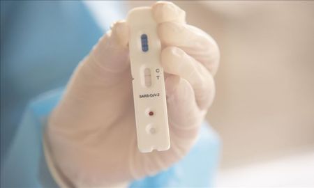 En el aeropuerto de Sauce Viejo ya se realizan test de antígenos y PCR / Imagen ilustrativa. En el aeropuerto de Sauce Viejo ya se realizan test de antígenos y PCR / Imagen ilustrativa.