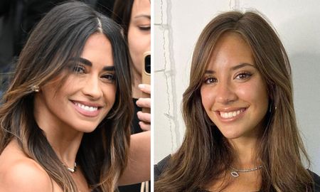 El sorprendente retoque estético de Antonela Rocuzzo en el rostro que impactó a todos El sorprendente retoque estético de Antonela Rocuzzo en el rostro que impactó a todos