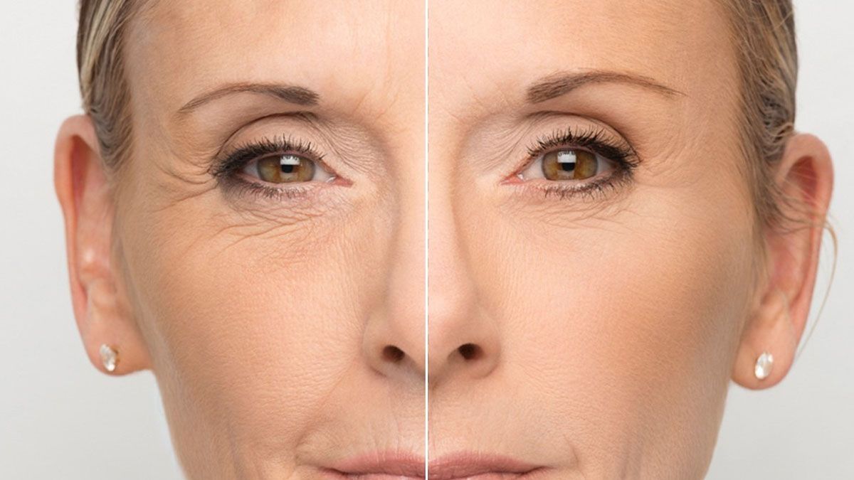 Ácido hialurónico ¿qué es y para qué se utiliza?