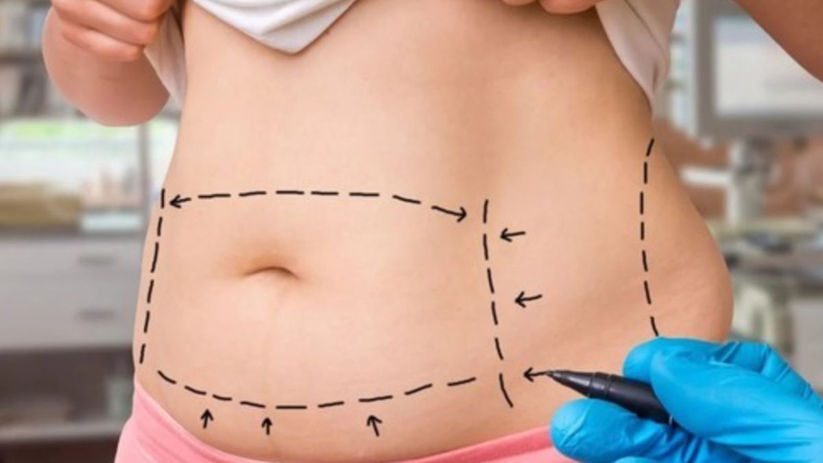 La víctima del caso era oriunda de Rafaela y murió tras realizar una lipoaspiración.&nbsp;