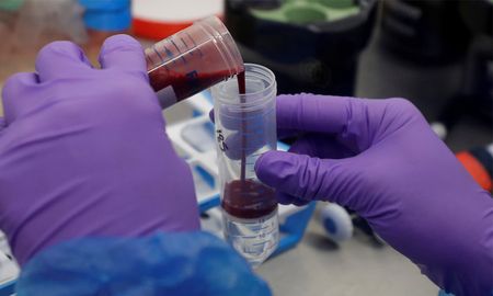 La investigación, publicada este jueves en Science, se basa en un experimento realizado por los virólogos de la Universidad de Wisconsin-Madison La investigación, publicada este jueves en Science, se basa en un experimento realizado por los virólogos de la Universidad de Wisconsin-Madison