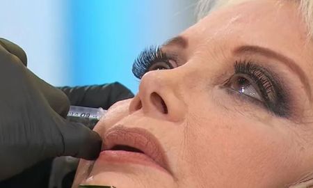 Carmen Barbieri se aplicó botox en vivo: el video Carmen Barbieri se aplicó botox en vivo: el video