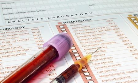 Científicos argentinos buscan detectar el Alzheimer con un estudio de sangre