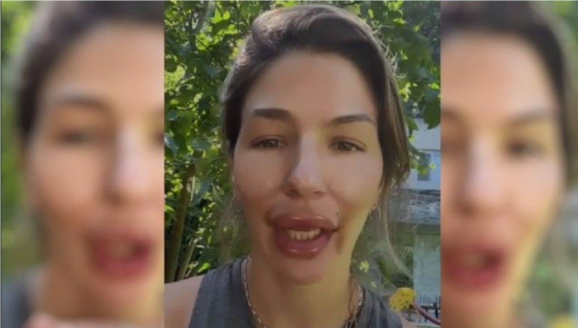 El retoque en los labios de Marcela Kloosterboer que sorprendió a sus fans 
