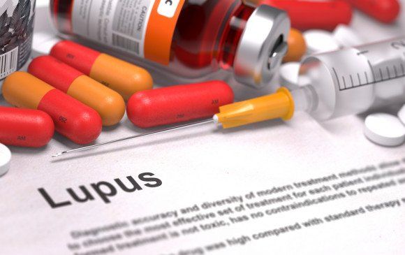 Lupus: descubren en Francia un medicamento sin efectos secundarios