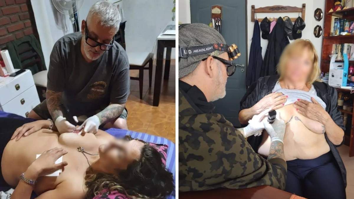 Diego Staropoli lleva más de 15 años reconstruyendo areolas mamarias de forma gratuita a mujeres que superaron el cáncer de mama.
