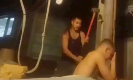 Un conscripto ruso se quebró el brazo con un martillo para no ir a la guerra.