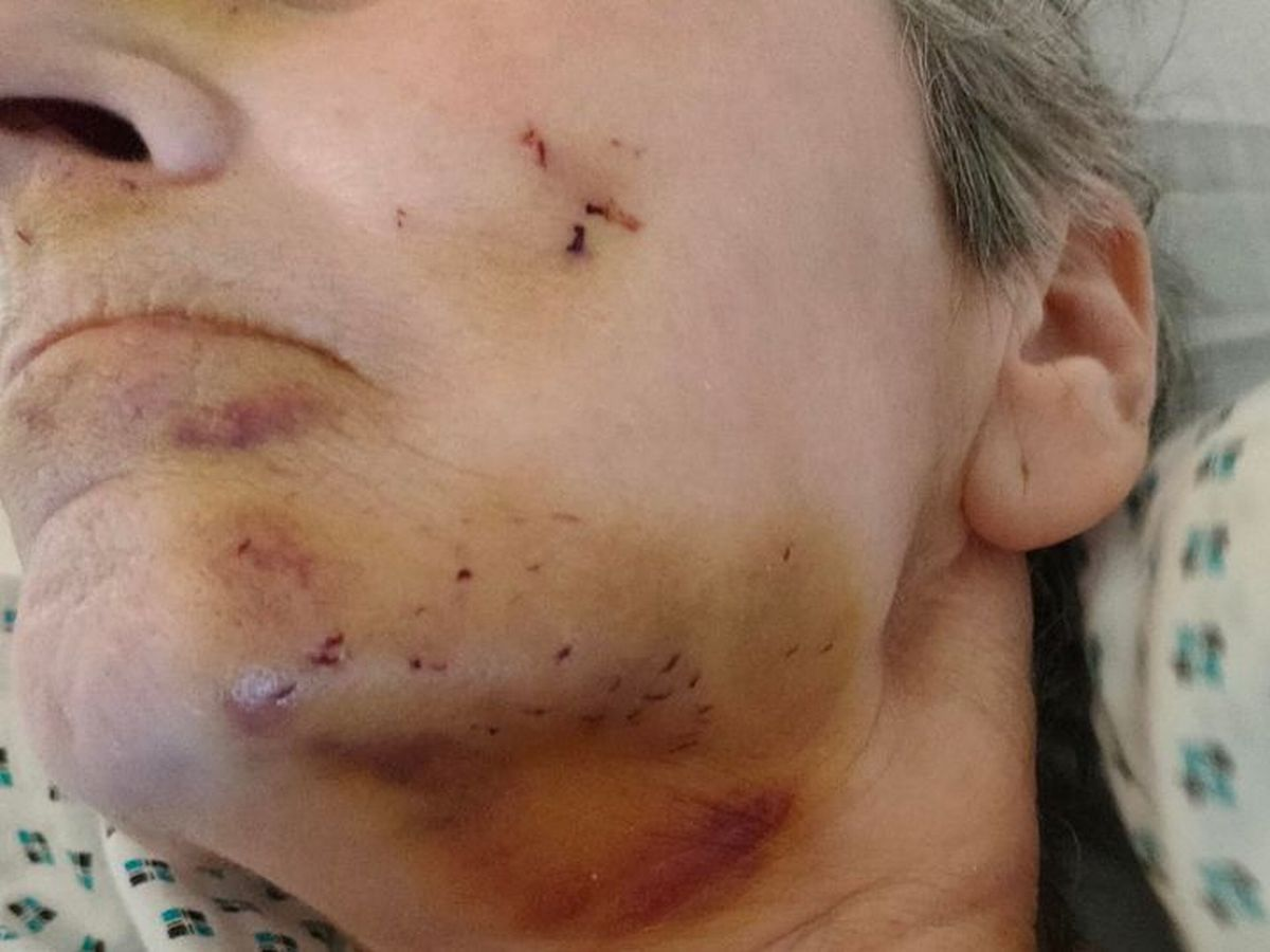 Un caso causó consternación en el Reino Unido