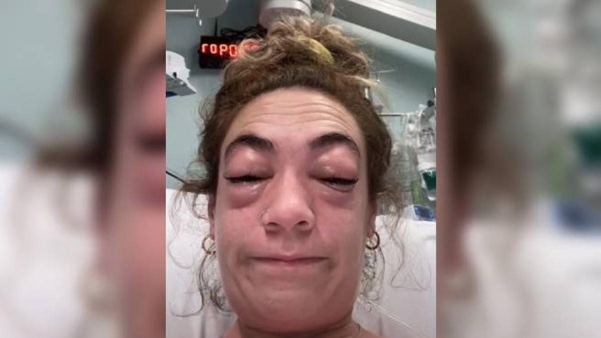 Una influencer se puso extensiones de pestañas