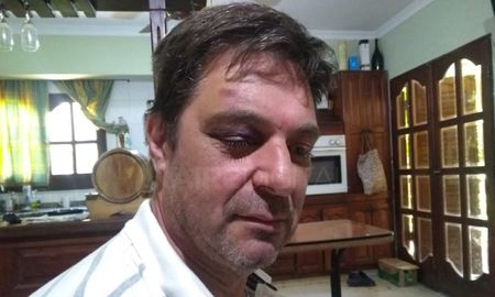 secuestrado, maniatado y torturado: ?me golpearon con un palo? secuestrado, maniatado y torturado: ?me golpearon con un palo?