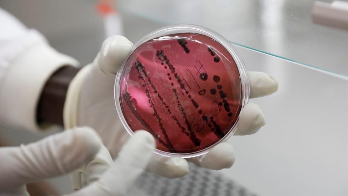 Investigadores de los Centros para el Control y la Prevención de Enfermedades (CDC) de EE.UU. descubrieron que un virus mortal llamado Chapare se puede contagiar de persona a persona