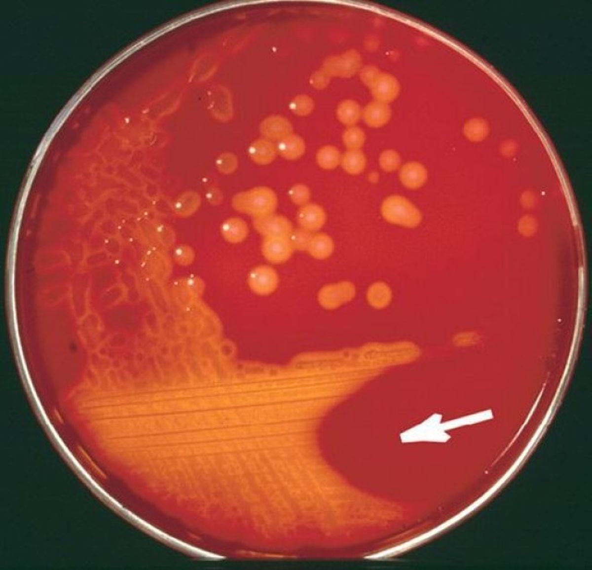 Streptococcus pyogenes, definida por la Universidad Nacional del Litoral como una enemiga silenciosa. Streptococcus pyogenes, definida por la Universidad Nacional del Litoral como una enemiga silenciosa.
