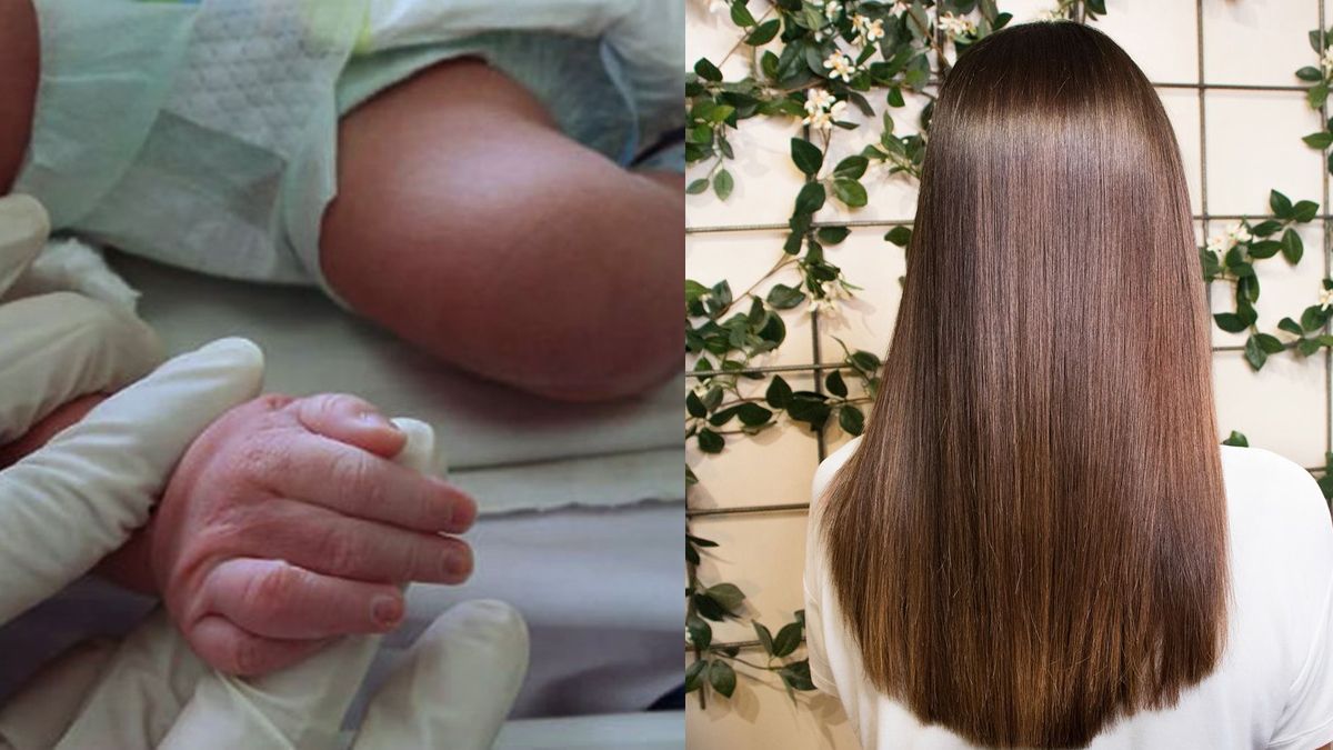 Un producto de alisado para el pelo provocó graves reacciones en un bebé de 6 meses.&nbsp;