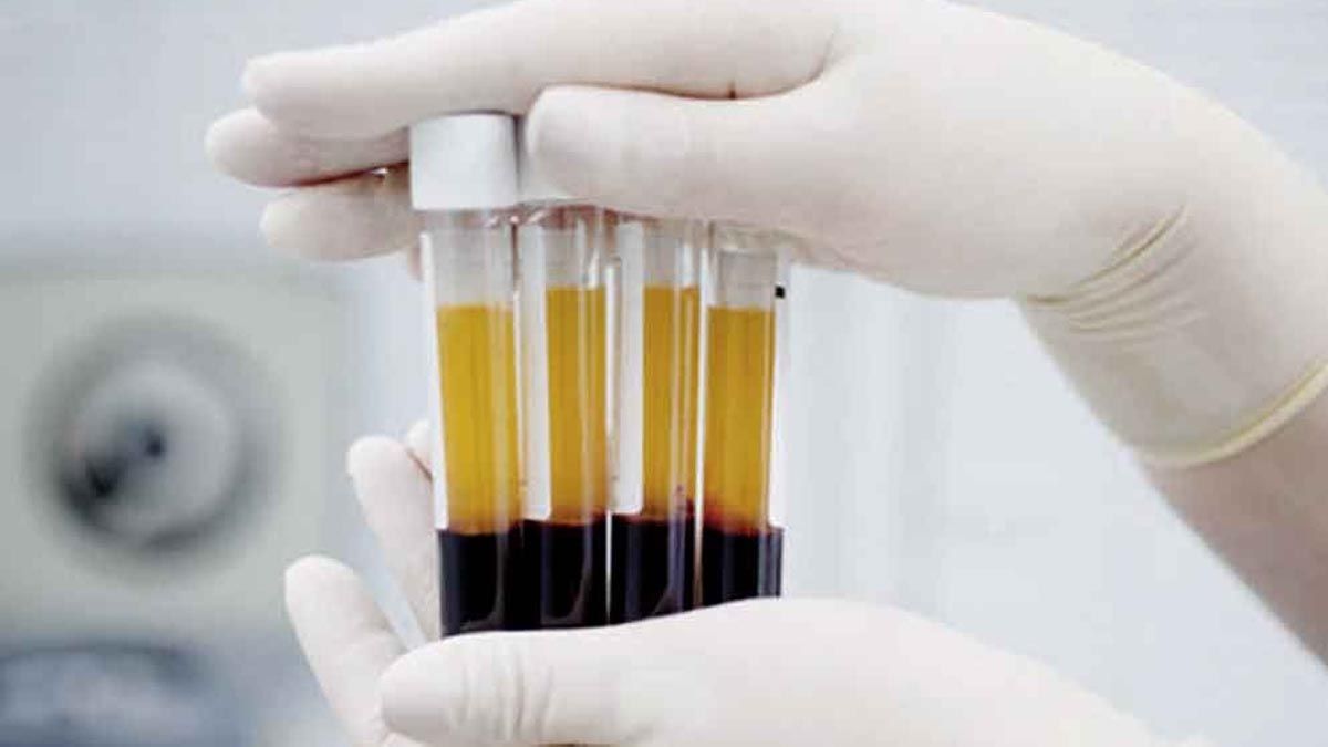 Hubo 56 donaciones efectivas de plasma en la provinica de Santa Fe.&nbsp;