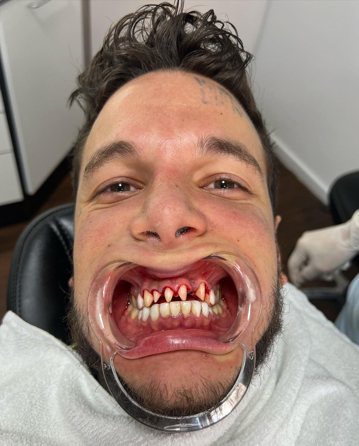 Los fanáticos de Alex Caniggia quedaron sorprendidos ante la naturaleza gráfica de las fotos compartidas por el conductor y por el sospechoso polvo blanco de su nariz.