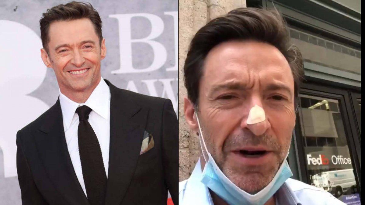 El actor Hugh Jackman