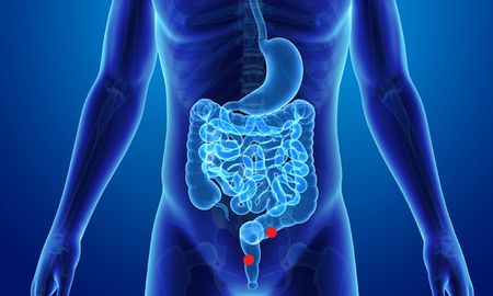 El Ministerio de Salud distribuirá test gratuitos para prevención del cáncer de colon.