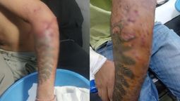 altText(Brutal ataque en Santa Fe: un joven de 19 años fue mordido por varios perros cuando volvía de trabajar)}