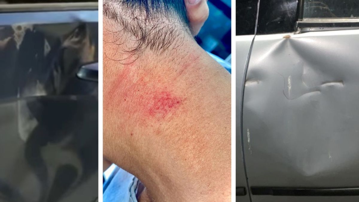 En primera instancia un jugador fue mordido en el cuello durante uno de los partidos y luego
