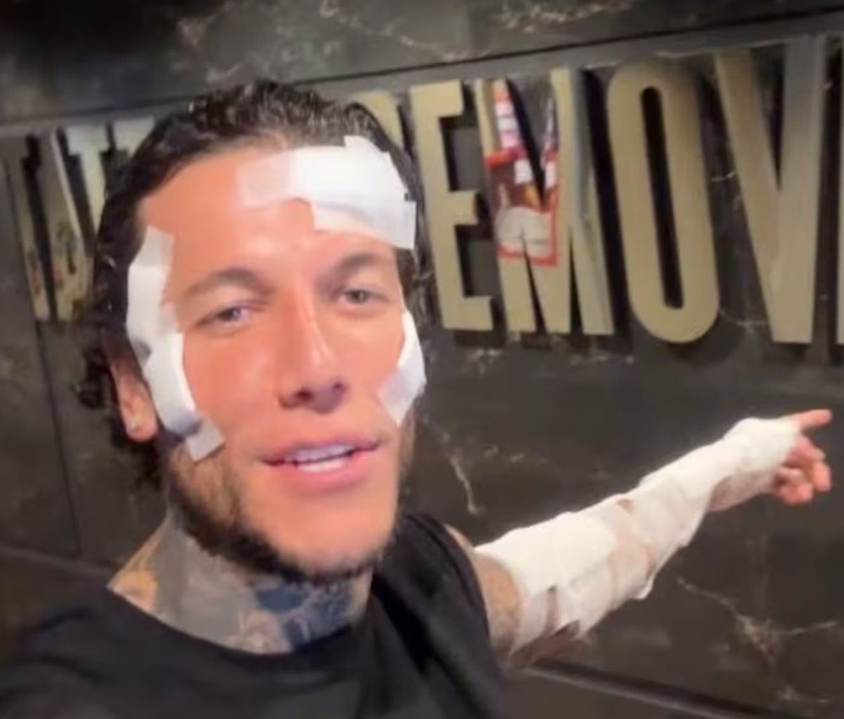 Alex Caniggia decidió someterse a un importante procedimiento estético y quitarse varios tatuajes. Alex Caniggia decidió someterse a un importante procedimiento estético y quitarse varios tatuajes.