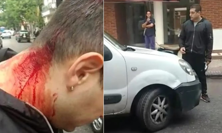Rosario: un hombre le pegó con un fierro en la cabeza a un taxista y lo arrastró en el capó Rosario: un hombre le pegó con un fierro en la cabeza a un taxista y lo arrastró en el capó