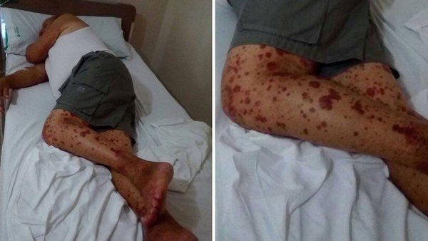 Marcelino Escalada: murió tras ser rociado con agroquímicos en el patio de su casa