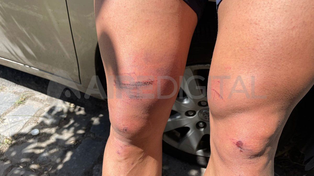 El joven de barrio Roma sufrió heridas en brazos y piernas al repeler la violenta entradera. El joven de barrio Roma sufrió heridas en brazos y piernas al repeler la violenta entradera.