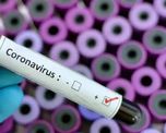 Para Stamboulian, la curva de contagios parece controlada por el efecto de las medidas de aislamiento social. Para Stamboulian, la curva de contagios parece controlada por el efecto de las medidas de aislamiento social.