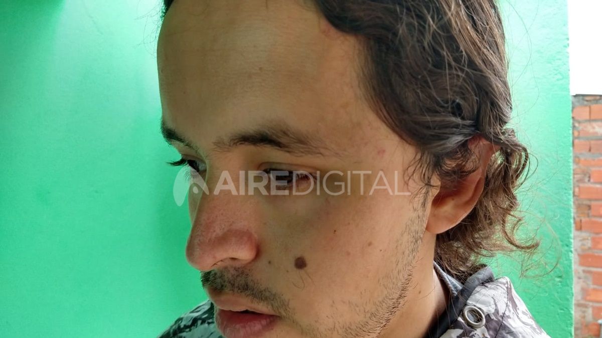 Recibi&oacute; el golpe en la zona de la sien.&nbsp;