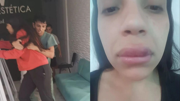 Le inyectaron un dudoso líquido en los labios, fue a reclamar y la echaron a los golpes.