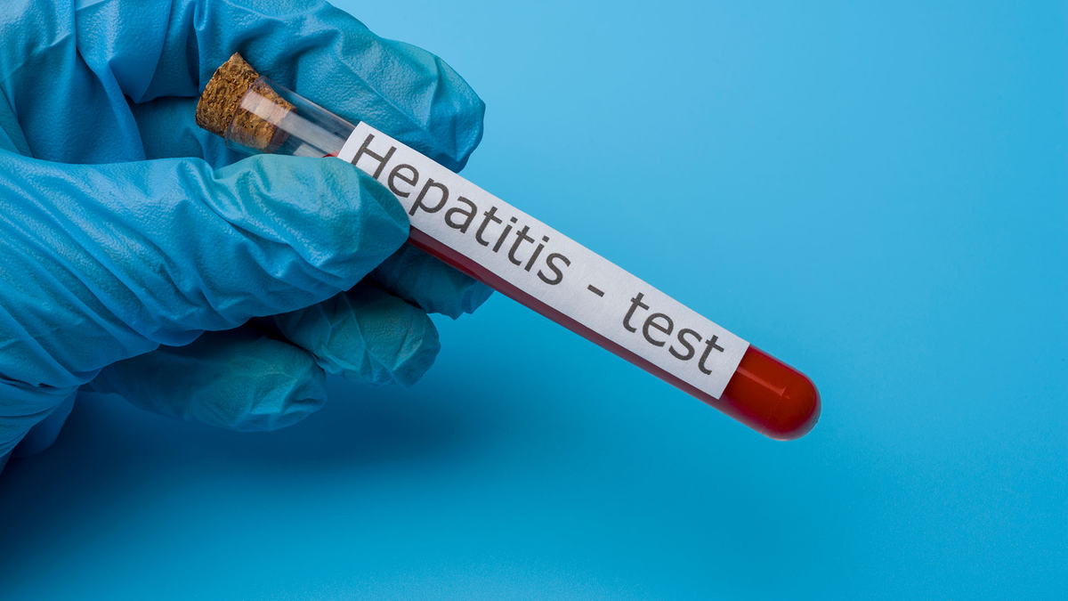 Día mundial contra la hepatitis: ¿por qué se conmemora el 28 de julio?