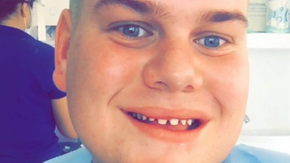 Tiene 28 años y lleva gastados 35.000 dólares para parecer perfecto