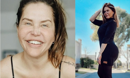 Nazarena Vélez se inyectó Botox en la cara y tuvo una reacción alérgica: Soy un chimpancé &nbsp;