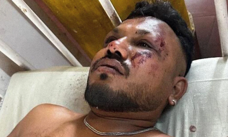 ramesh viswashkumar viajaba en el avion de india air y vivio para contarlo: pense que yo tambien iba a morir ramesh viswashkumar viajaba en el avion de india air y vivio para contarlo: pense que yo tambien iba a morir