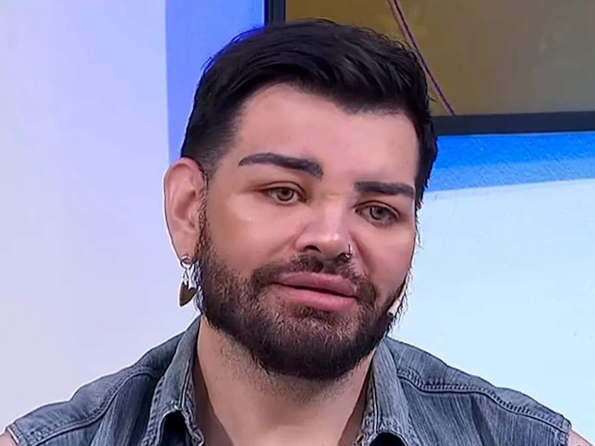 Fran Mariano sufre de grandes problemas de salud tras someterse a 20 cirugías con Aníbal Lotocki. Fran Mariano sufre de grandes problemas de salud tras someterse a 20 cirugías con Aníbal Lotocki.