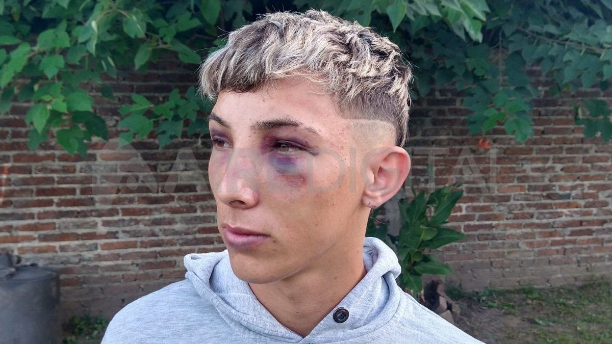 Patovicas golpearon brutalmente a un joven en un boliche de la ruta nacional 168