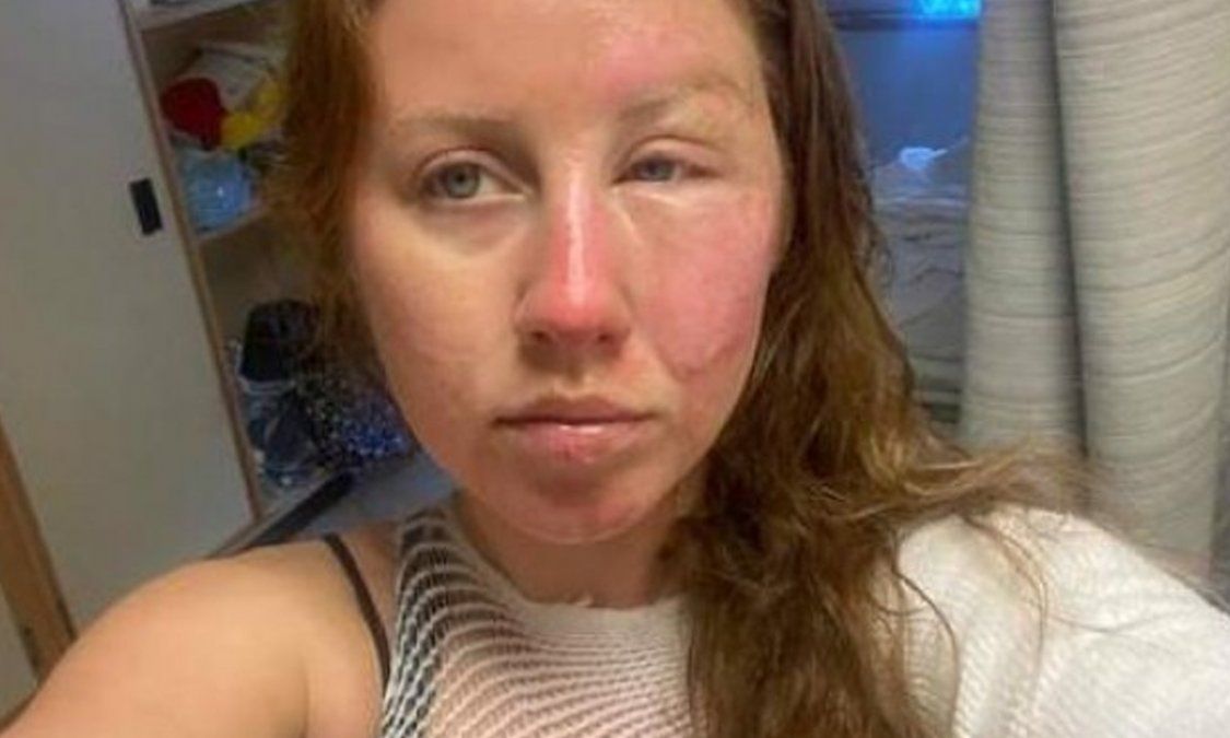 “Este trágico evento nunca debió haber ocurrido y podría haberse evitado fácilmente si estas personas no hubieran sido tan descuidadas con sus acciones” dijo la joven que fue quemada por el mozo.