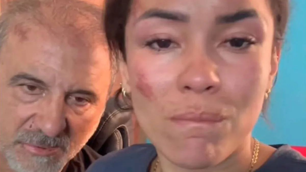 Luego del ataque, la pareja contó en sus redes sociales el calvario que pasaron. Luego del ataque, la pareja contó en sus redes sociales el calvario que pasaron.