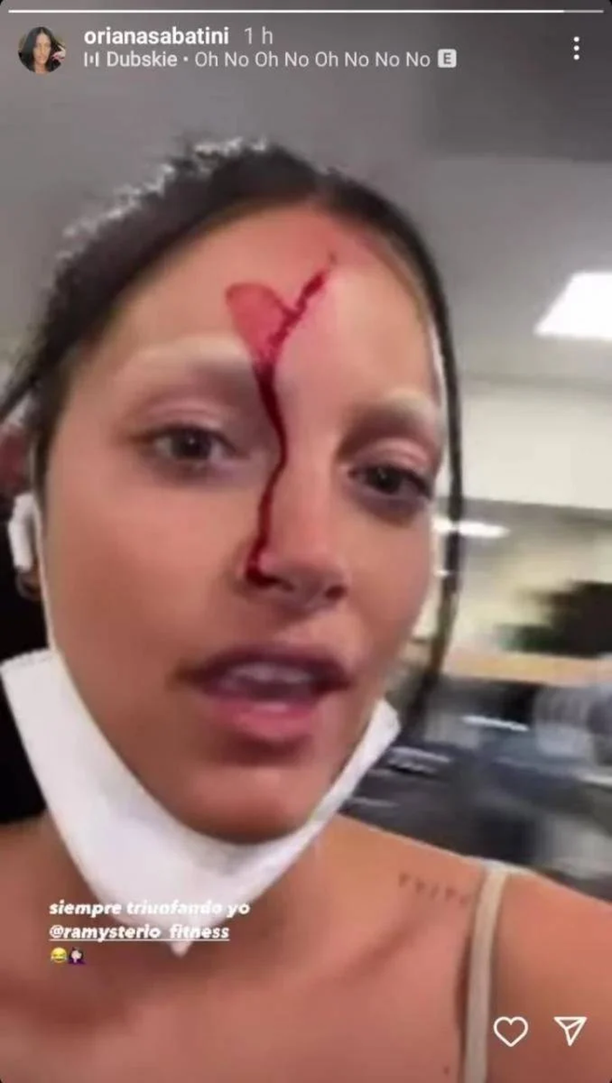 Carmen Barbieri hizo un picante comentario sobre el accidente de Oriana Sabatini.