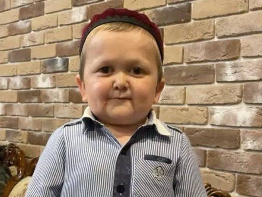 Viral: la extraña enfermedad que hace que un joven se vea como un niño.