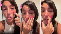 altText(Catalina Gorostidi padece un problema de salud y alarmó a sus seguidores: 