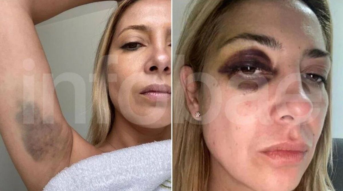 Las impactantes imágenes difundidas por Infobae de Fabiola Yáñez golpeada.
