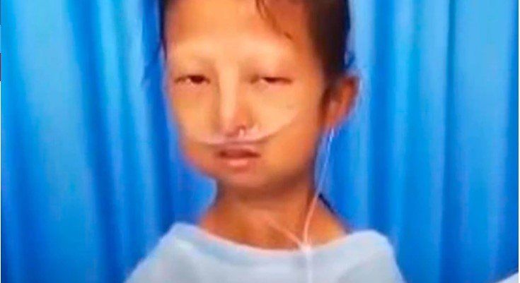 La historia de la  joven que se alimentó sólo de arroz y chiles durante 5 años para sostener a su hermano enfermo