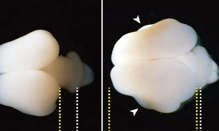 insertan genes humanos en fetos de monos y logran que les crezca el cerebro insertan genes humanos en fetos de monos y logran que les crezca el cerebro
