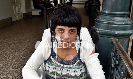 Bernarda Massolo dialogó con Aire de Santa Fe mientras se recuperaba en el Hospital Cullen, en diciembre de 2018. Bernarda Massolo dialogó con Aire de Santa Fe mientras se recuperaba en el Hospital Cullen, en diciembre de 2018.