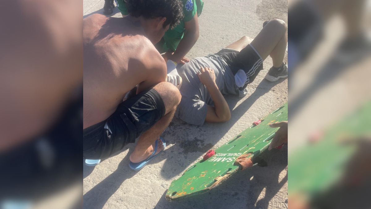 Facu Mazzei fue atropellado por una moto. Facu Mazzei fue atropellado por una moto.