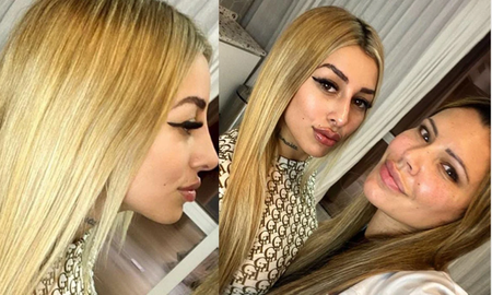 Tamara Báez compartió a través de sus redes sociales cómo quedó su boca, luego de un retoque estético. Tamara Báez compartió a través de sus redes sociales cómo quedó su boca, luego de un retoque estético.