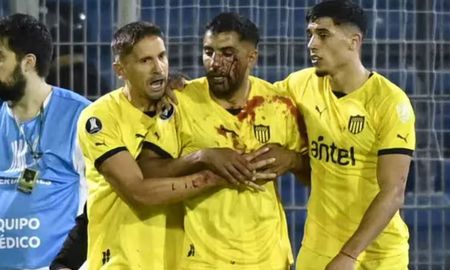 El hincha de Rosario Central que agredió al futbolista de Peñarol, no podrá ingresar a un espectáculo deportivo durante dos años. El hincha de Rosario Central que agredió al futbolista de Peñarol, no podrá ingresar a un espectáculo deportivo durante dos años.