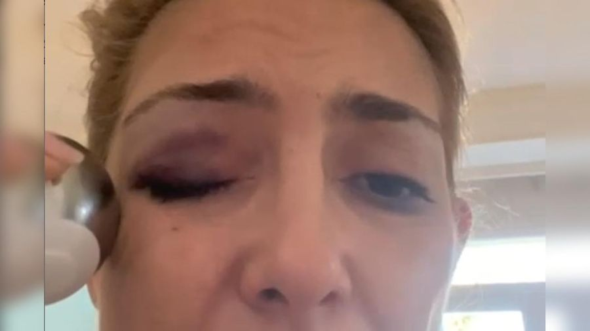 La ex esteticista de Fabiola Yañez, Florencia Aguirre, y Federico Alem, un médico que la atendió en la quinta de Olivos, declararán hoy en el marco de la causa por violencia de género contra el ex presidente Alberto Fernández La ex esteticista de Fabiola Yañez, Florencia Aguirre, y Federico Alem, un médico que la atendió en la quinta de Olivos, declararán hoy en el marco de la causa por violencia de género contra el ex presidente Alberto Fernández