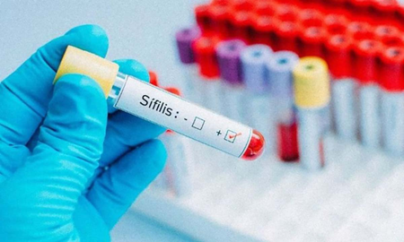 crece el contagio de infecciones de transmision sexual: la importancia del preservativo crece el contagio de infecciones de transmision sexual: la importancia del preservativo